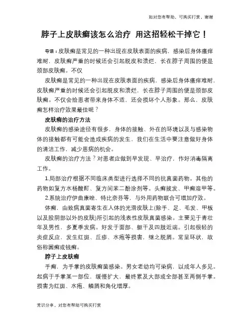 脖子上皮肤癣该怎么治疗 用这招轻松干掉它!