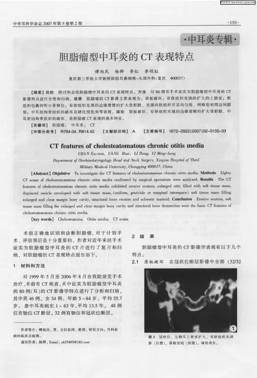 胆脂瘤型中耳炎的CT表现特点