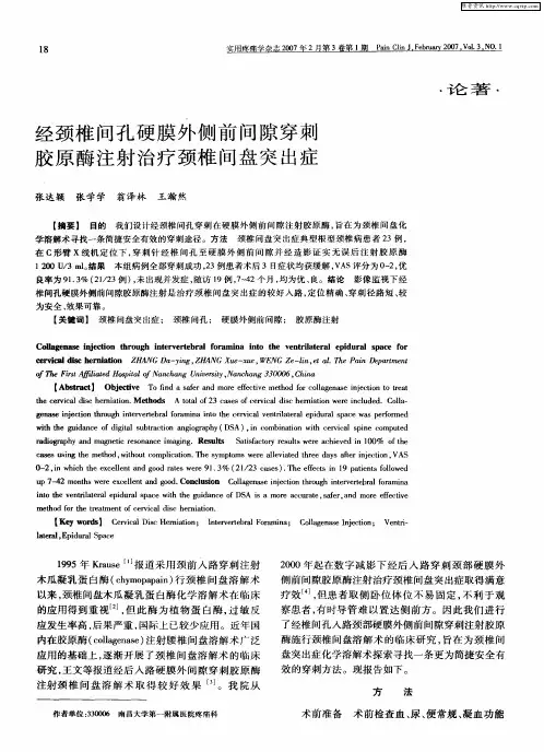 经颈椎间孔硬膜外侧前间隙穿刺胶原酶注射治疗颈椎间盘突出症