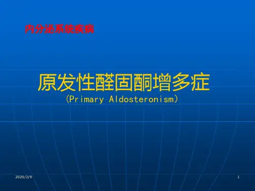 原发性醛固酮增多症