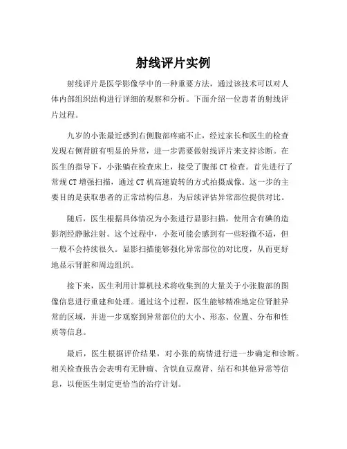 射线评片实例