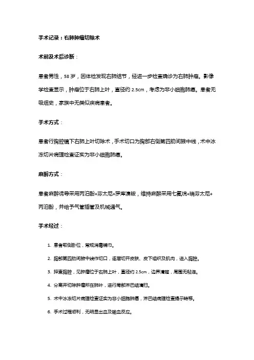手术记录：右肺肿瘤切除术