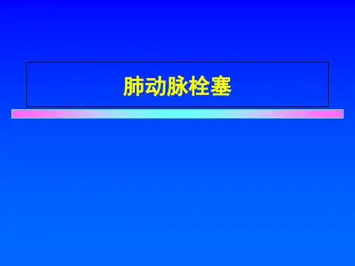 肺动脉栓塞PPT课件
