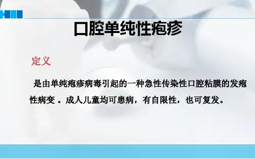 口腔单纯性疱疹