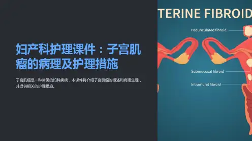 妇产科护理课件：子宫肌瘤的病理及护理措施
