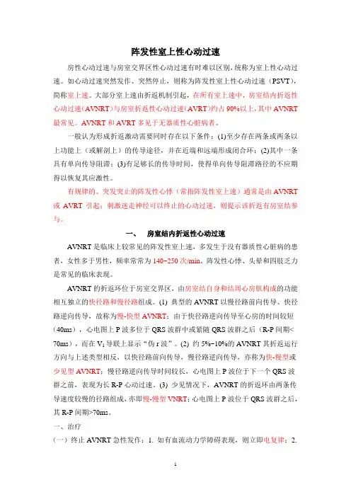 阵发性室上速