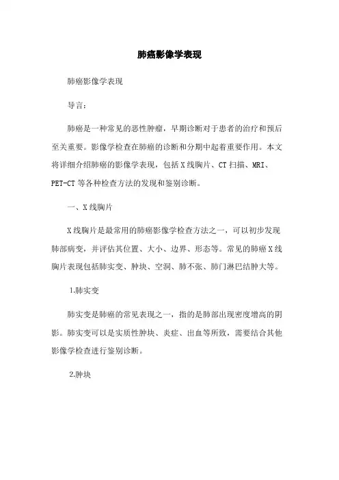 肺癌影像学表现