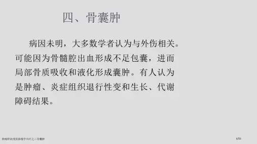 肿瘤样病变的影像学诊疗之三骨囊肿