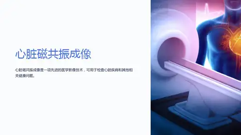心脏磁共振成像