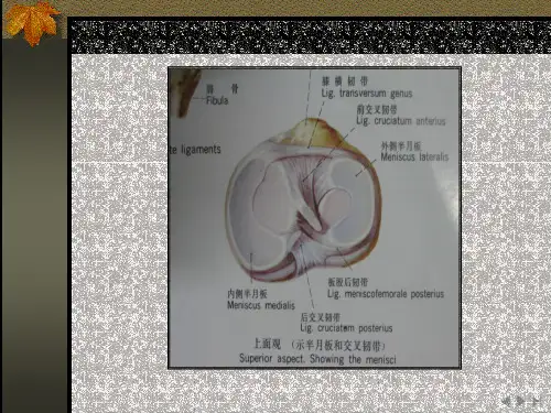半月板损伤的MR表现课件