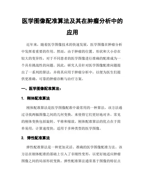医学图像配准算法及其在肿瘤分析中的应用