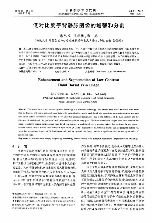 低对比度手背静脉图像的增强和分割