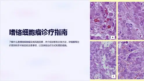 嗜铬细胞瘤诊疗指南