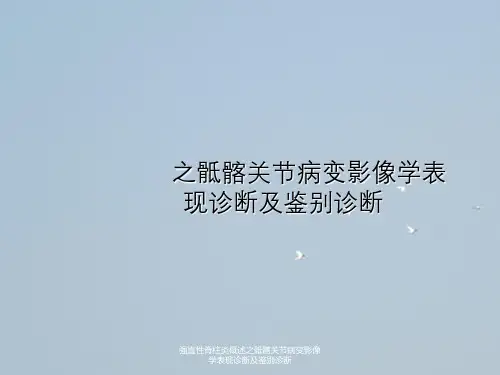强直性脊柱炎概述之骶髂关节病变影像学表现诊断及鉴别诊断