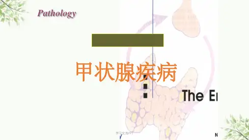 病理学(第八版)最新内分泌系统疾病课件