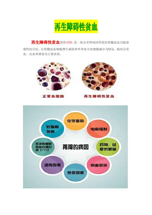 再生障碍性贫血相关知识