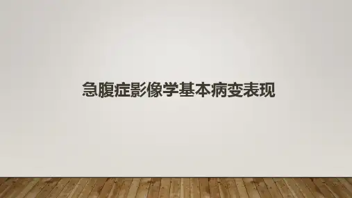 急腹症影像学基本病变表现