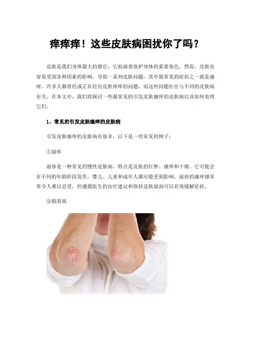 痒痒痒！这些皮肤病困扰你了吗？