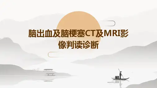 脑出血及脑梗塞CT及MRI影像判读诊断