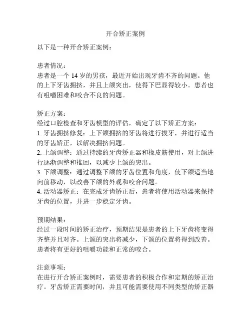 开合矫正案例