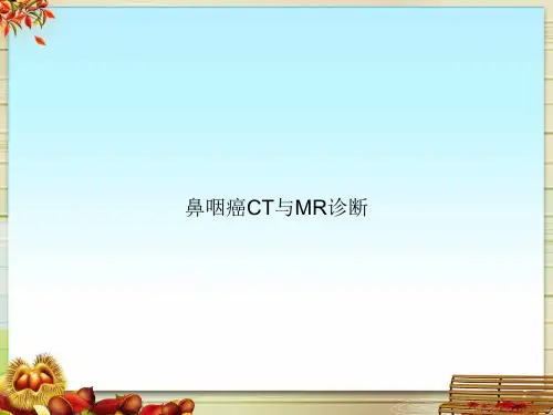鼻咽癌CT与MR诊断