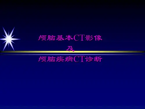 颅脑基本CT影像及颅脑疾病CT诊断