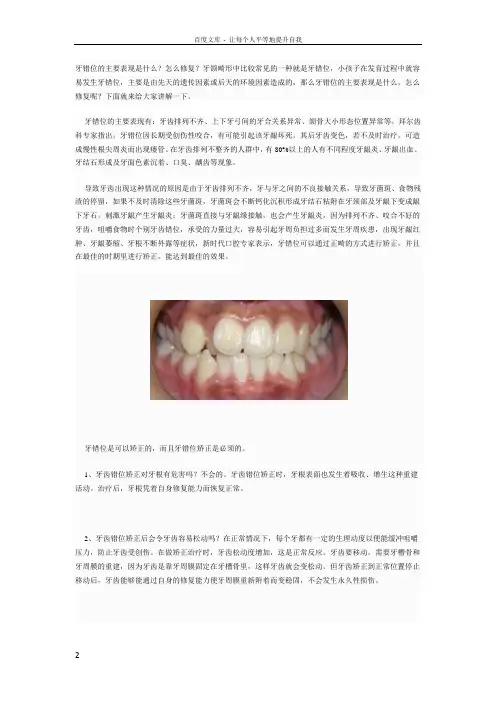 牙齿错位的具体表现及矫正解答