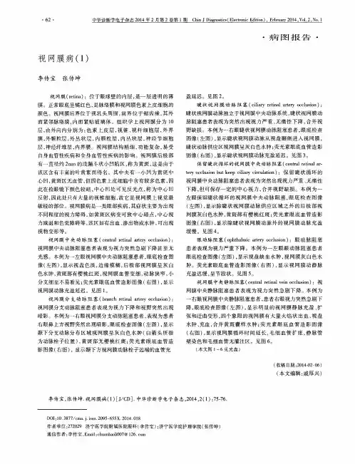 视网膜病(1)