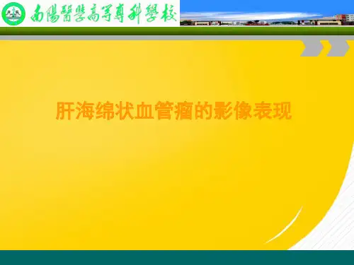 2022肝海绵状血管瘤优秀ppt