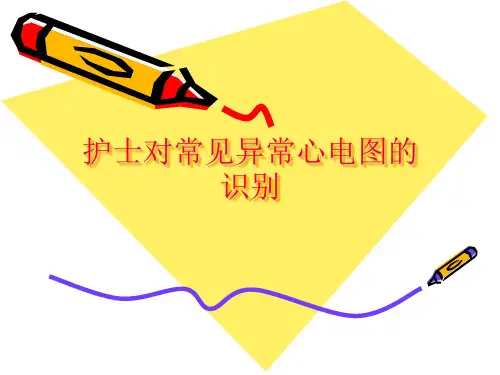 常见异常心电图的识别(护理)