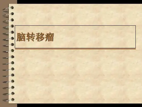 脑转移瘤PPT课件
