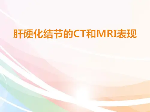 肝硬化结节的CT和MRI表现