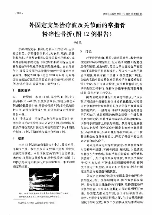 外固定支架治疗波及关节面的掌指骨粉碎性骨折(附12例报告)