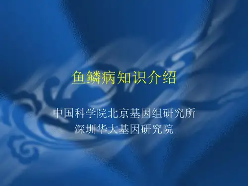 鱼鳞病(蛇皮癣)知识介绍