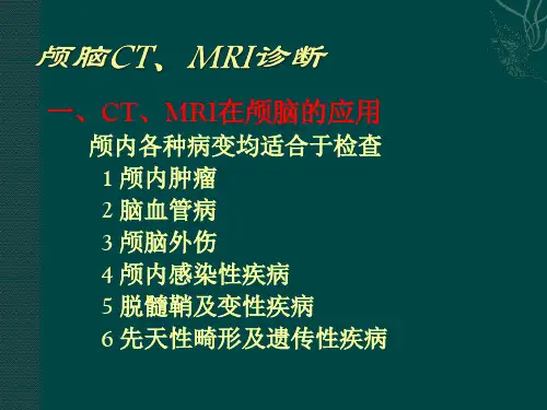 颅脑CT、MRI诊断