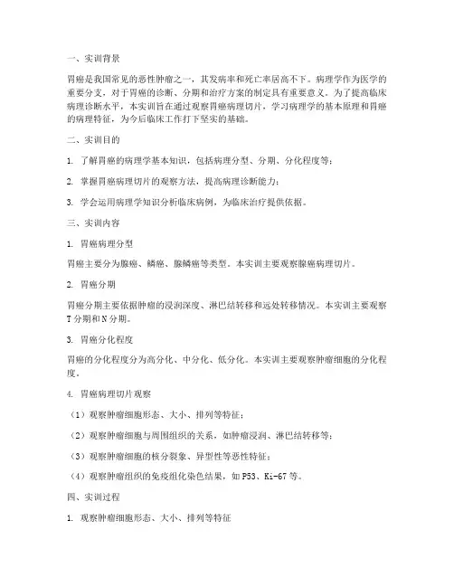 胃癌病理实训报告