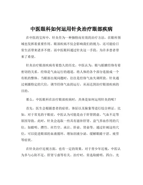 中医眼科如何运用针灸治疗眼部疾病
