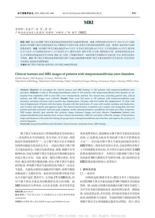 颞下颌关节紊乱病患者临床特征及MRI影像表现