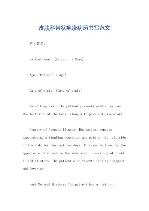 皮肤科带状疱疹病历书写范文