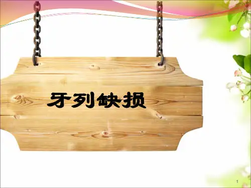 牙列缺损PPT课件