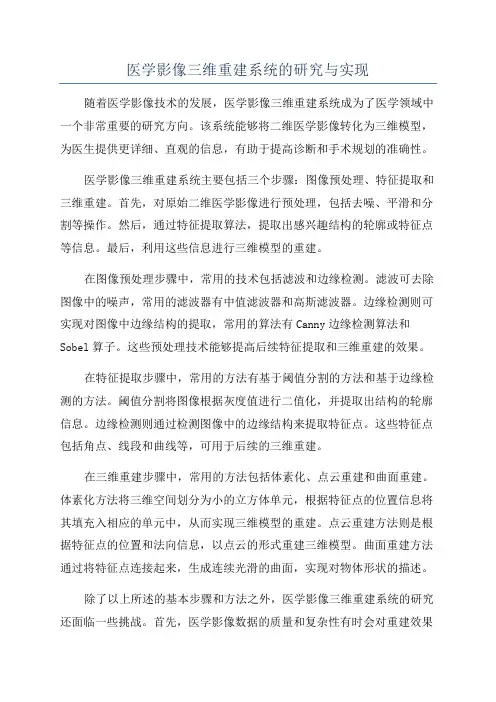 医学影像三维重建系统的研究与实现