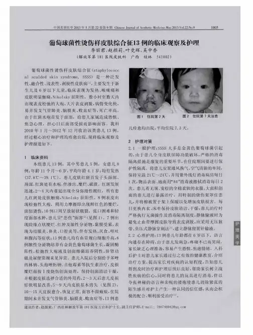 葡萄球菌性烫伤样皮肤综合征13例的临床观察及护理