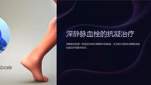 深静脉血栓的抗凝治疗