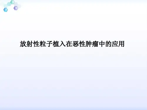 放射性粒子植入技术PPT课件
