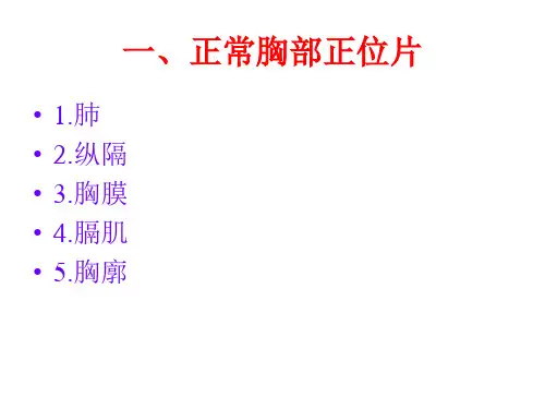 诊断学X线常见影像学读片课件