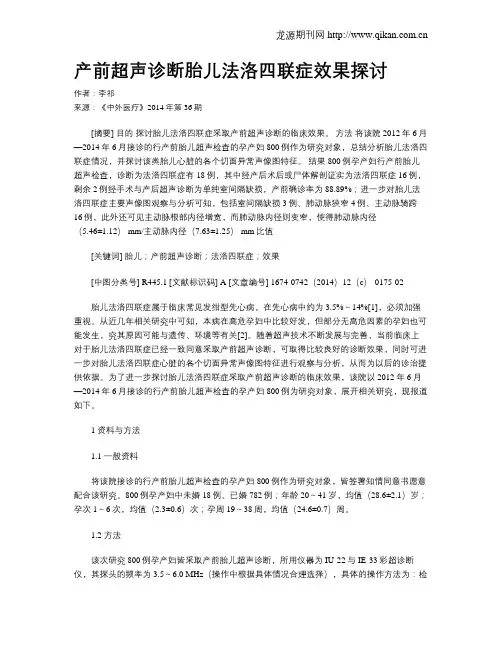 产前超声诊断胎儿法洛四联症效果探讨