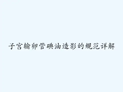 子宫输卵管碘油造影的规范详解 PPT