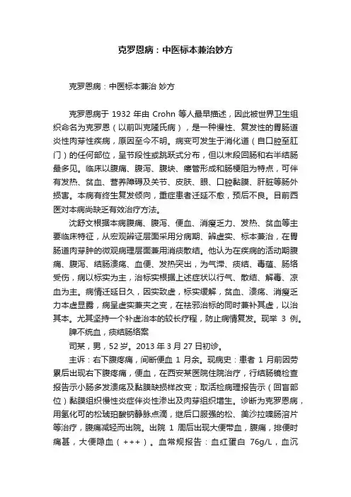克罗恩病：中医标本兼治妙方