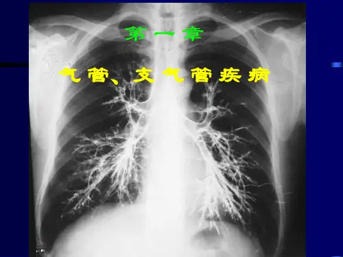 胸部疾病的影像学诊断ppt课件