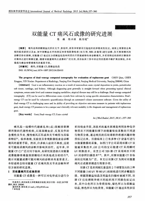 双能量CT痛风石成像的研究进展